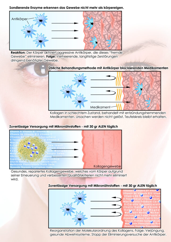 Alen gegen DEGENERATIVE PROZESSE VON COLLAGEN